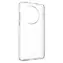 FIXED TPU-Gelhülle Story für OnePlus 13 klar