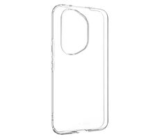 FIXED TPU-Gelhülle Story für Honor 400 Pro klar